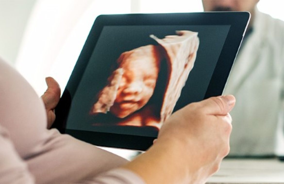 Third Trimester Scan (3D/4D)