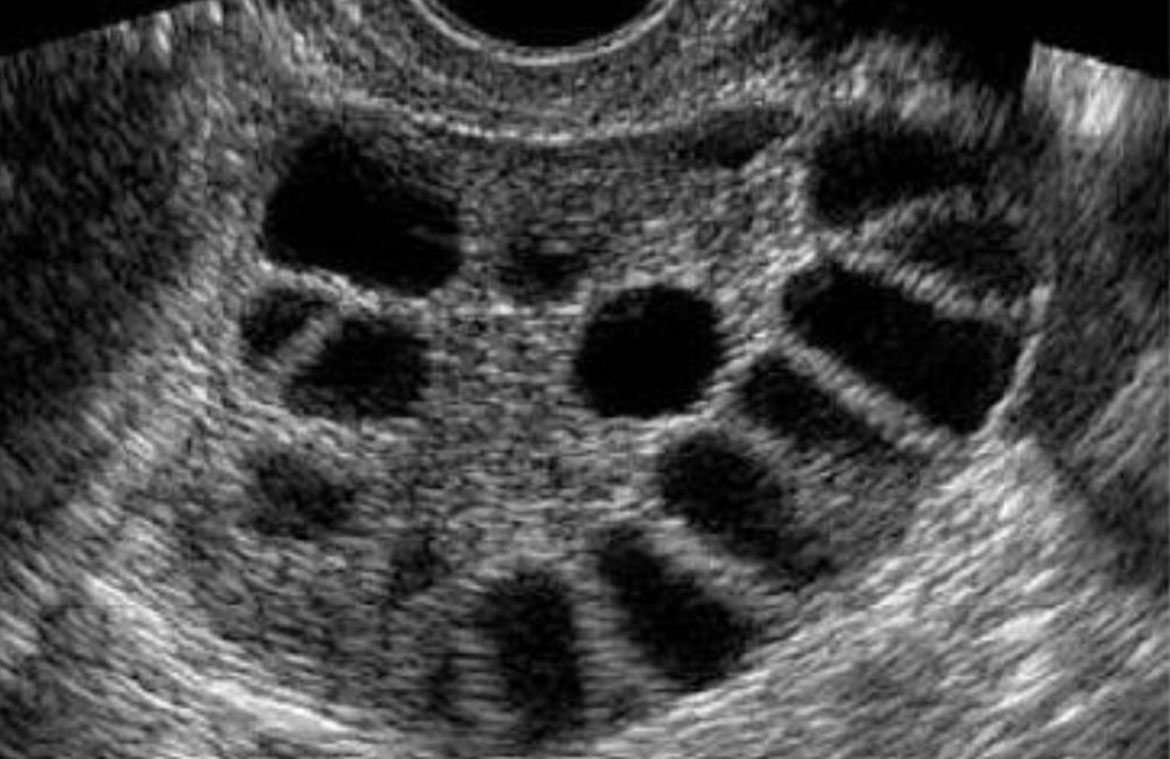 Pathology Test